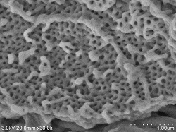 Glomerular-cleavage-conductive-staining2